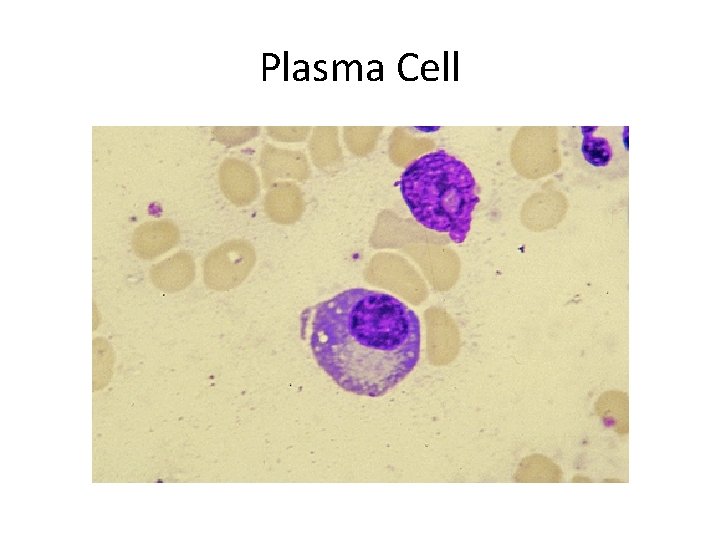 Plasma Cell 