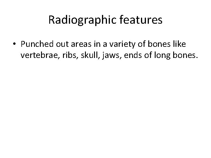 Radiographic features • Punched out areas in a variety of bones like vertebrae, ribs,