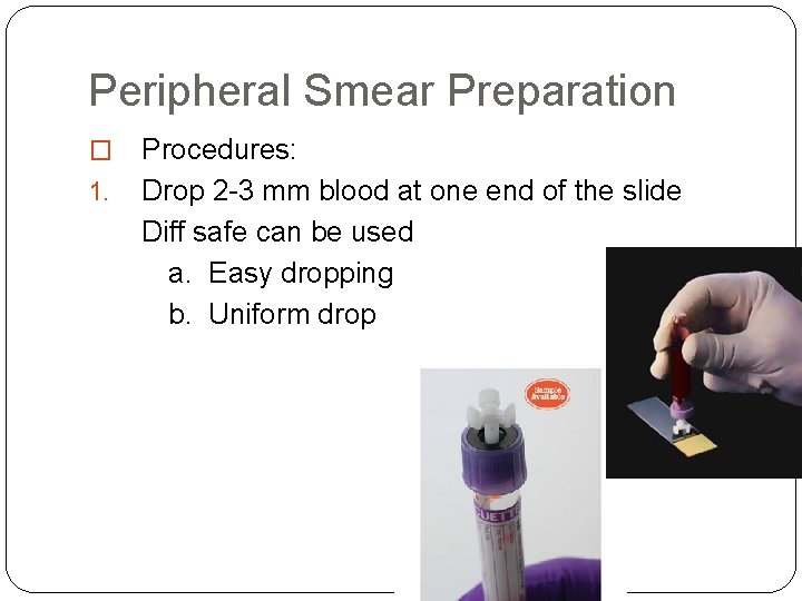 Peripheral Smear Preparation � 1. Procedures: Drop 2 -3 mm blood at one end Peripheral Smear Preparation � 1. Procedures: Drop 2 -3 mm blood at one end
