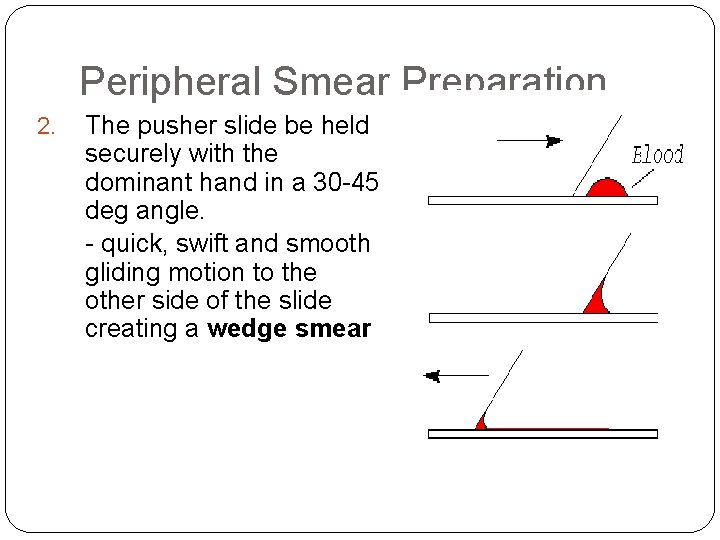 Peripheral Smear Preparation 2. The pusher slide be held securely with the dominant hand Peripheral Smear Preparation 2. The pusher slide be held securely with the dominant hand