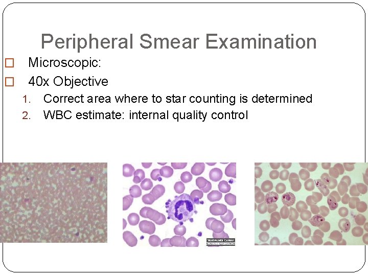 Peripheral Smear Examination Microscopic: � 40 x Objective � 1. 2. Correct area where Peripheral Smear Examination Microscopic: � 40 x Objective � 1. 2. Correct area where