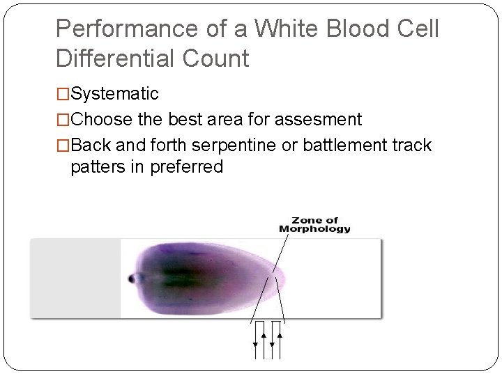 Performance of a White Blood Cell Differential Count �Systematic �Choose the best area for Performance of a White Blood Cell Differential Count �Systematic �Choose the best area for