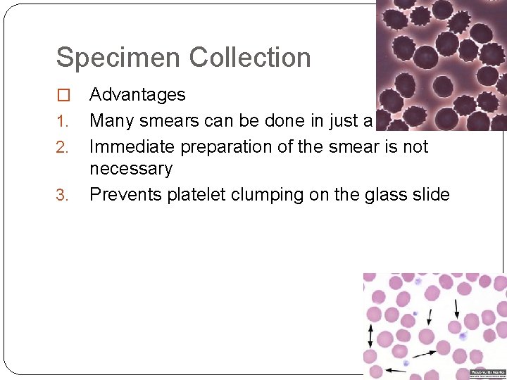 Specimen Collection � 1. 2. 3. Advantages Many smears can be done in just Specimen Collection � 1. 2. 3. Advantages Many smears can be done in just