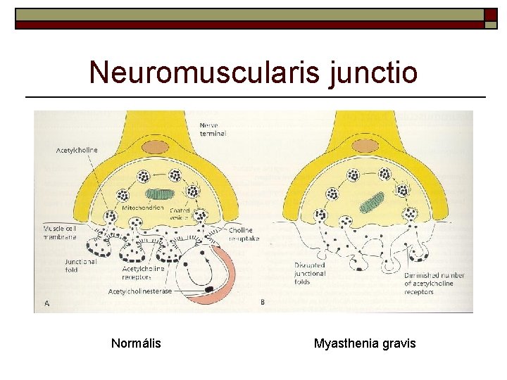 Neuromuscularis junctio Normális Myasthenia gravis 