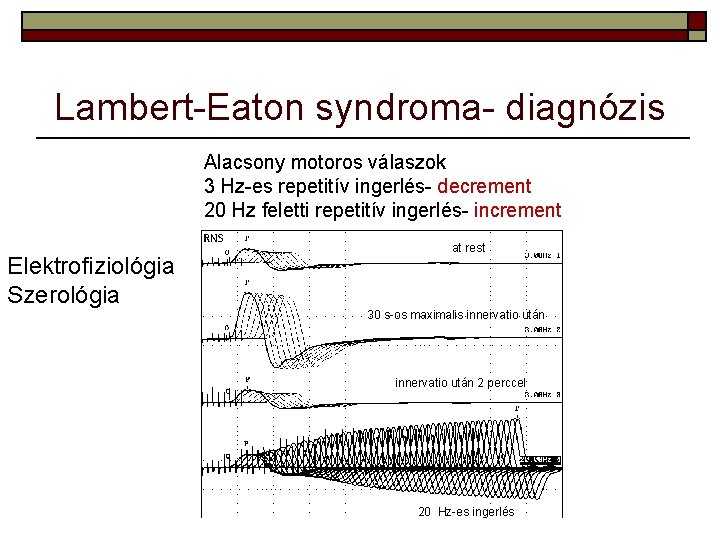 Lambert-Eaton syndroma- diagnózis Alacsony motoros válaszok 3 Hz-es repetitív ingerlés- decrement 20 Hz feletti