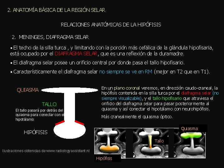2. ANATOMÍA BÁSICA DE LA REGIÓN SELAR RELACIONES ANATÓMICAS DE LA HIPÓFISIS 2. MENINGES,