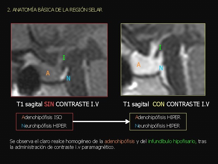 2. ANATOMÍA BÁSICA DE LA REGIÓN SELAR I I A A N N T