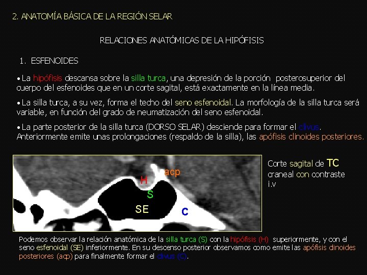 2. ANATOMÍA BÁSICA DE LA REGIÓN SELAR RELACIONES ANATÓMICAS DE LA HIPÓFISIS 1. ESFENOIDES