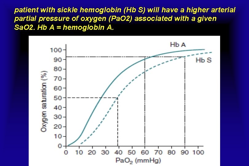patient with sickle hemoglobin (Hb S) will have a higher arterial partial pressure of