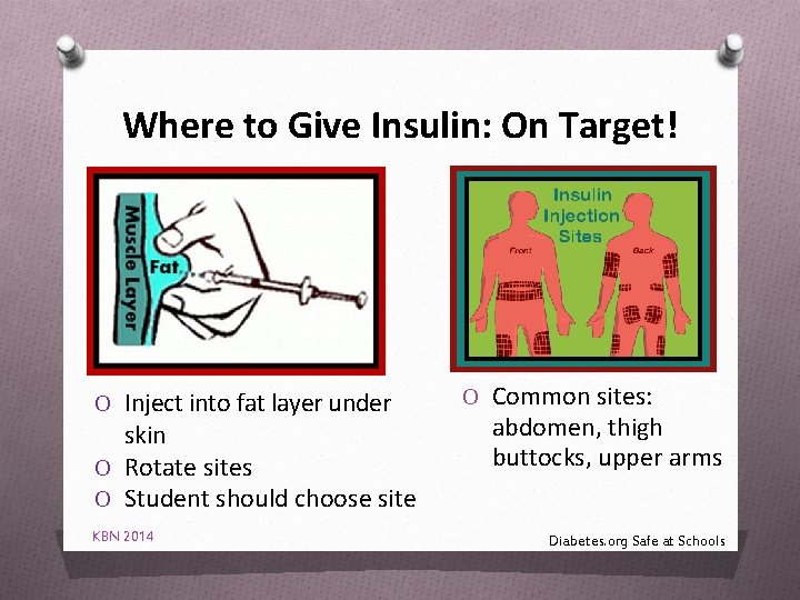 Where to Give Insulin: On Target! O Inject into fat layer under skin O