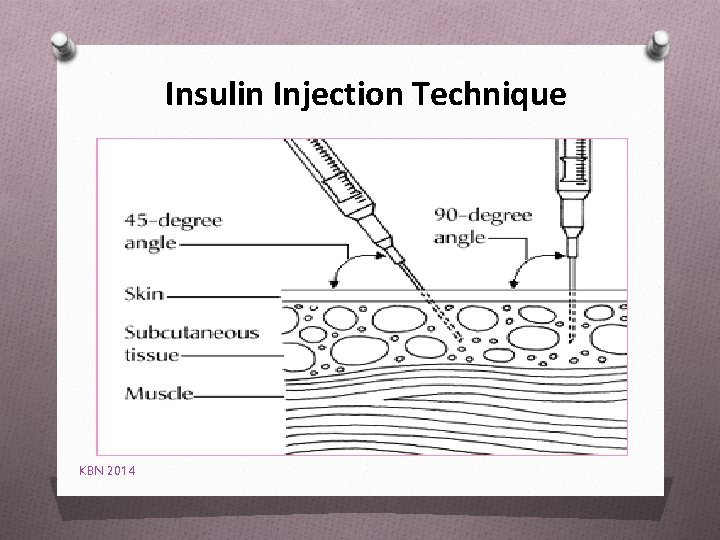 Insulin Injection Technique KBN 2014 