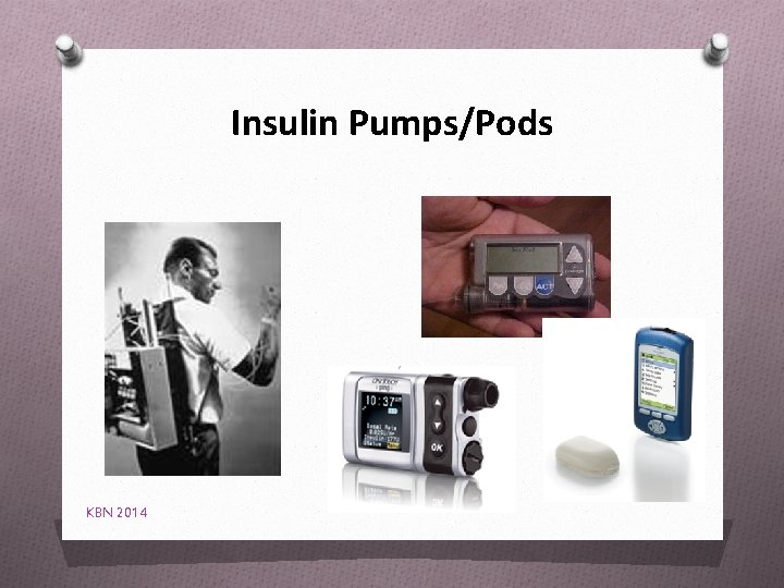Insulin Pumps/Pods KBN 2014 