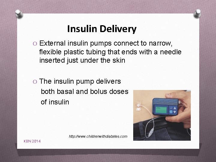 Insulin Delivery O External insulin pumps connect to narrow, flexible plastic tubing that ends