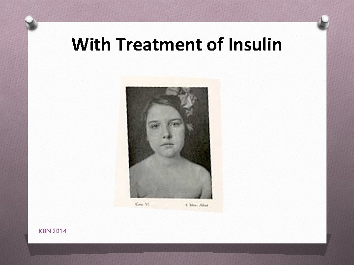 With Treatment of Insulin KBN 2014 