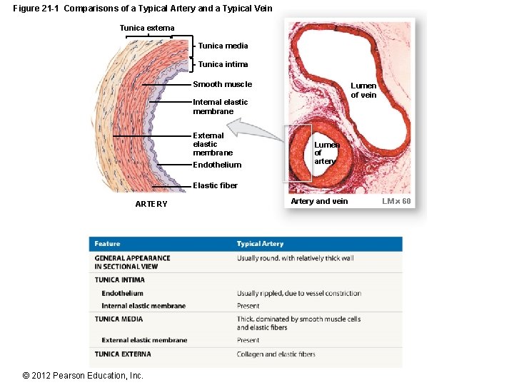 Figure 21 -1 Comparisons of a Typical Artery and a Typical Vein Tunica externa