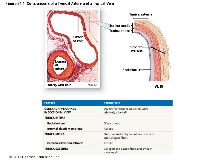 Figure 21 -1 Comparisons of a Typical Artery and a Typical Vein Tunica externa