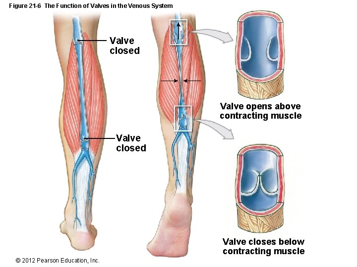 Figure 21 -6 The Function of Valves in the Venous System Valve closed Valve