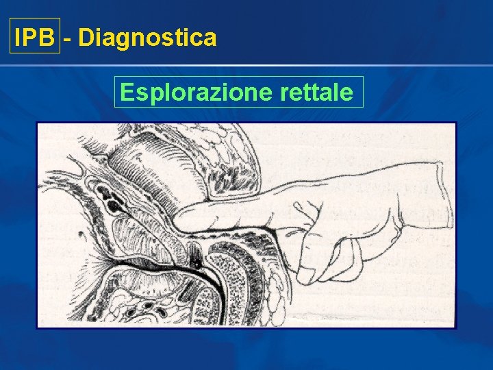IPB - Diagnostica Esplorazione rettale IPB - Diagnostica Esplorazione rettale