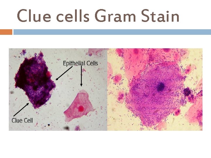 Clue cells Gram Stain 