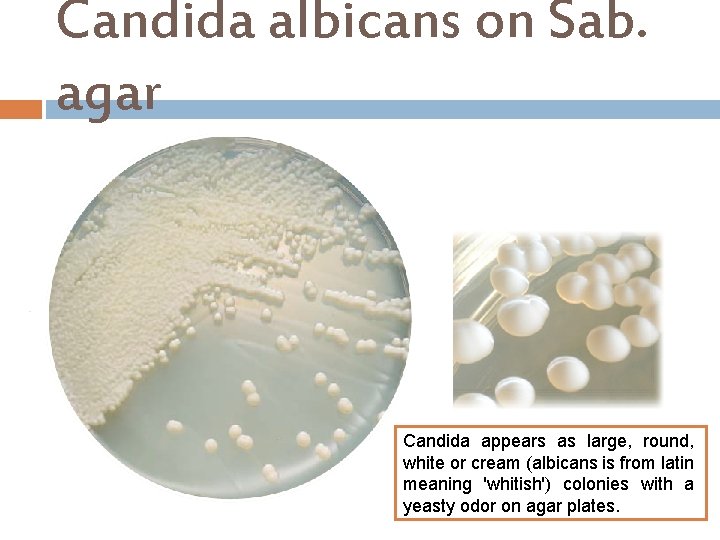 Candida albicans on Sab. agar Candida appears as large, round, white or cream (albicans