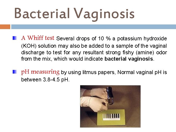 Bacterial Vaginosis A Whiff test Several drops of 10 % a potassium hydroxide (KOH)