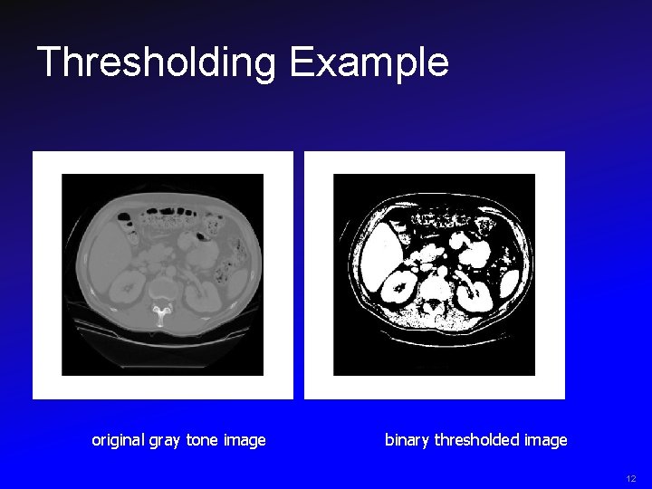 Thresholding Example original gray tone image binary thresholded image 12 