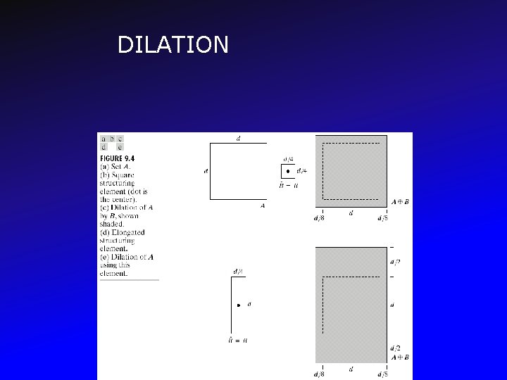 DILATION 