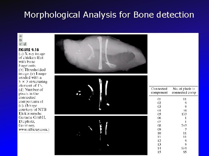 Morphological Analysis for Bone detection 