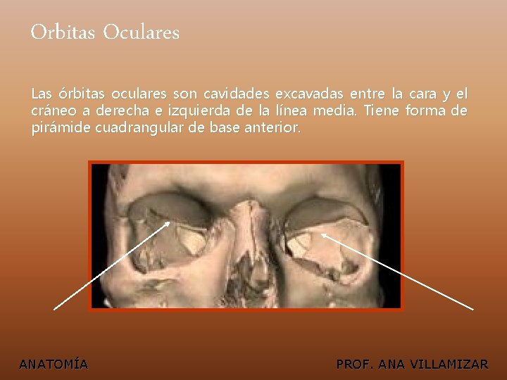 Orbitas Oculares Las órbitas oculares son cavidades excavadas entre la cara y el cráneo