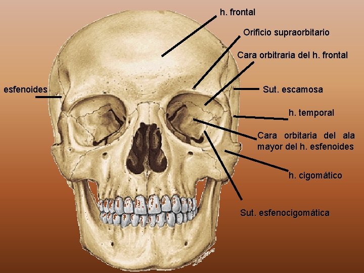 h. frontal Orificio supraorbitario Cara orbitraria del h. frontal esfenoides Sut. escamosa h. temporal