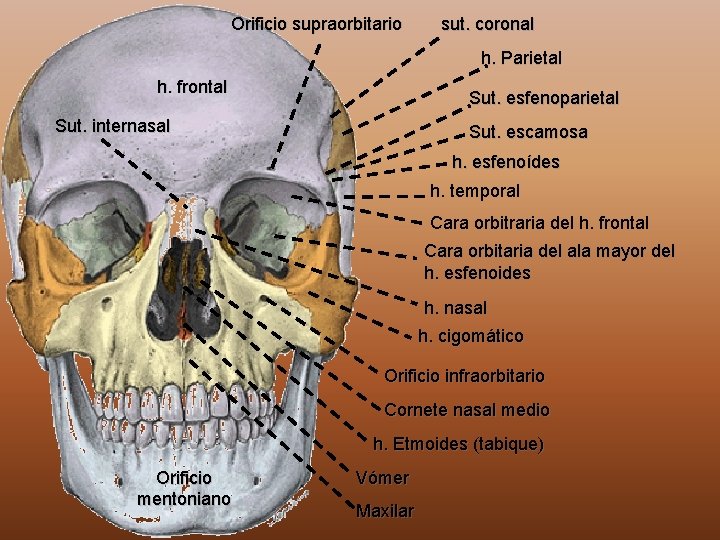 Orificio supraorbitario sut. coronal h. Parietal h. frontal Sut. esfenoparietal Sut. internasal Sut. escamosa