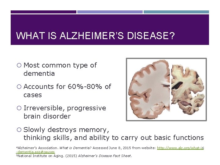 WHAT IS ALZHEIMER’S DISEASE? Most common type of dementia Accounts for 60%-80% of cases