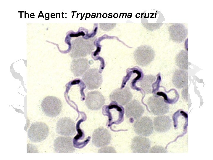 The Agent: Trypanosoma cruzi 