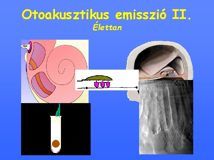 Otoakusztikus emisszió II. Élettan 