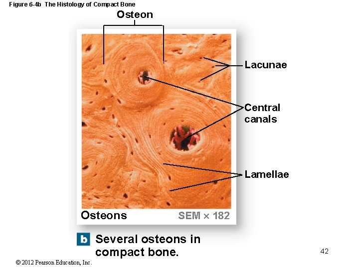 Figure 6 -4 b The Histology of Compact Bone Osteon Lacunae Central canals Lamellae