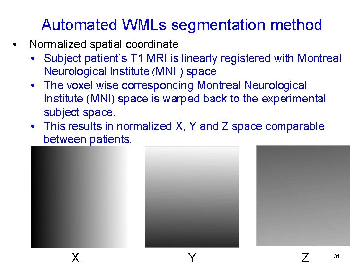 Automated WMLs segmentation method • Normalized spatial coordinate • Subject patient’s T 1 MRI