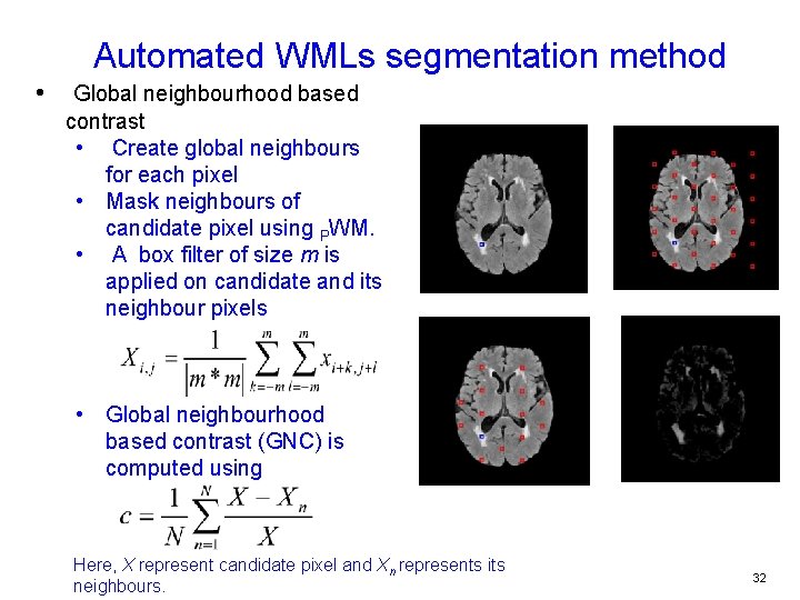 Automated WMLs segmentation method • Global neighbourhood based contrast • Create global neighbours for