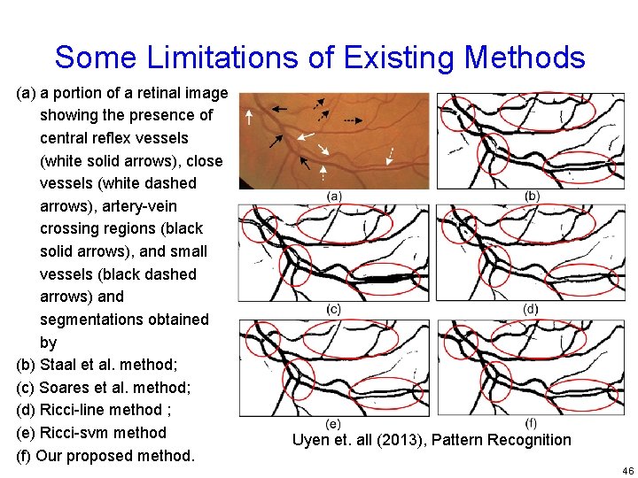 Some Limitations of Existing Methods (a) a portion of a retinal image showing the