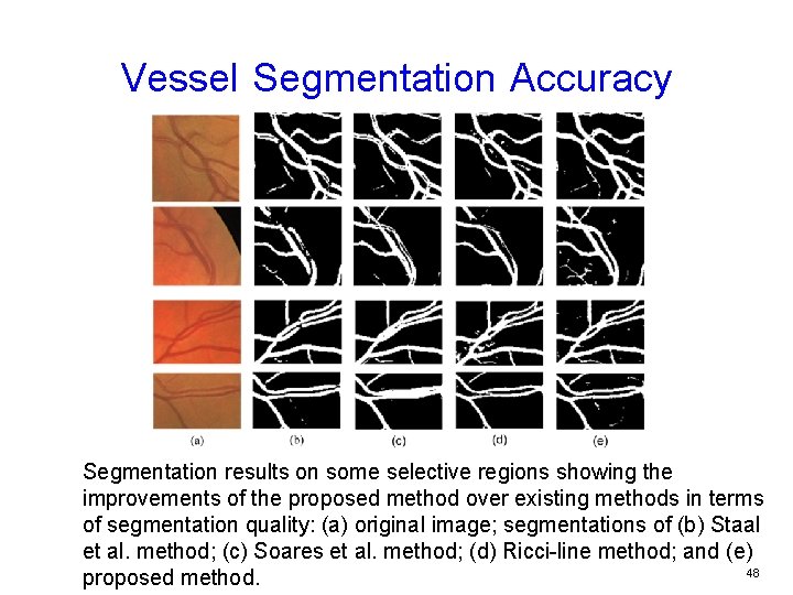 Vessel Segmentation Accuracy Segmentation results on some selective regions showing the improvements of the