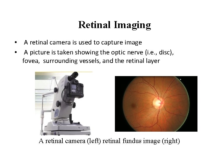 Retinal Imaging • A retinal camera is used to capture image • A picture