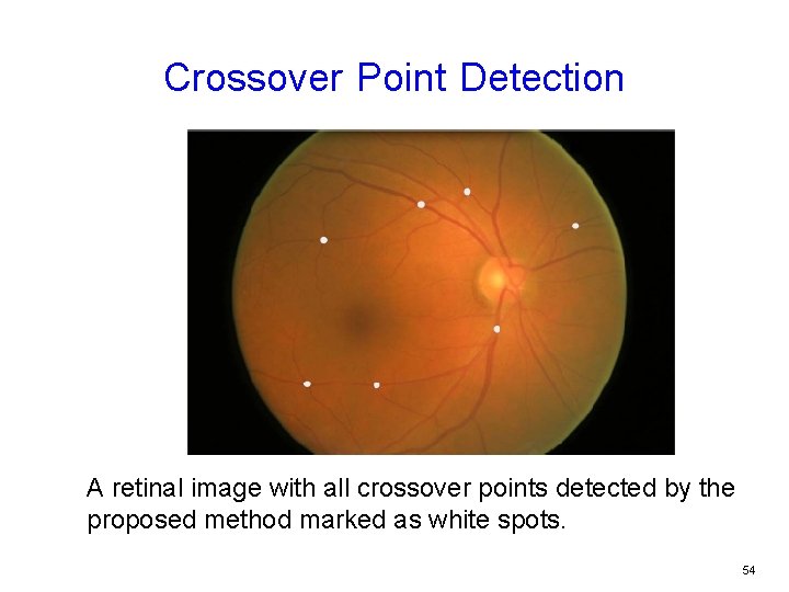 Crossover Point Detection A retinal image with all crossover points detected by the proposed