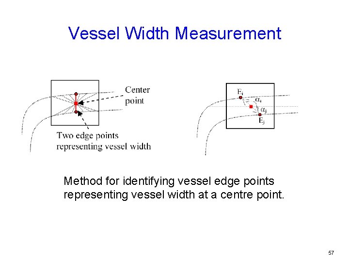 Vessel Width Measurement Method for identifying vessel edge points representing vessel width at a