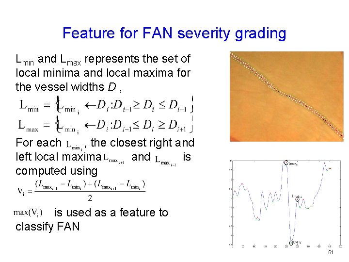 Feature for FAN severity grading Lmin and Lmax represents the set of local minima