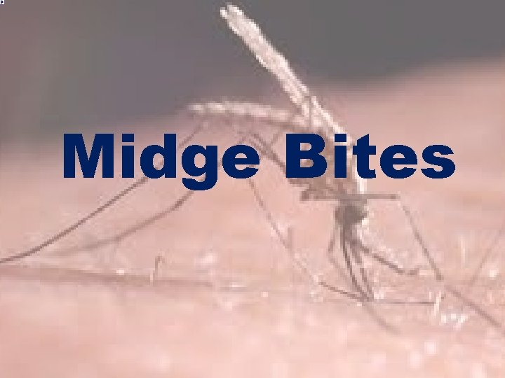 Midge Bites 
