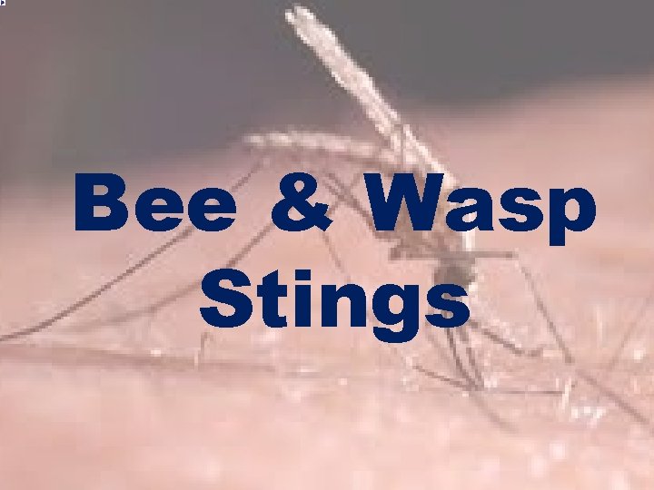 Bee & Wasp Stings 