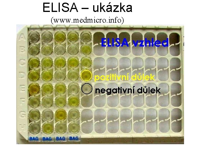 ELISA – ukázka (www. medmicro. info) 