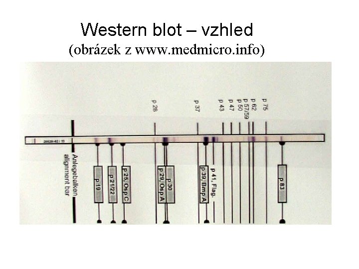 Western blot – vzhled (obrázek z www. medmicro. info) 