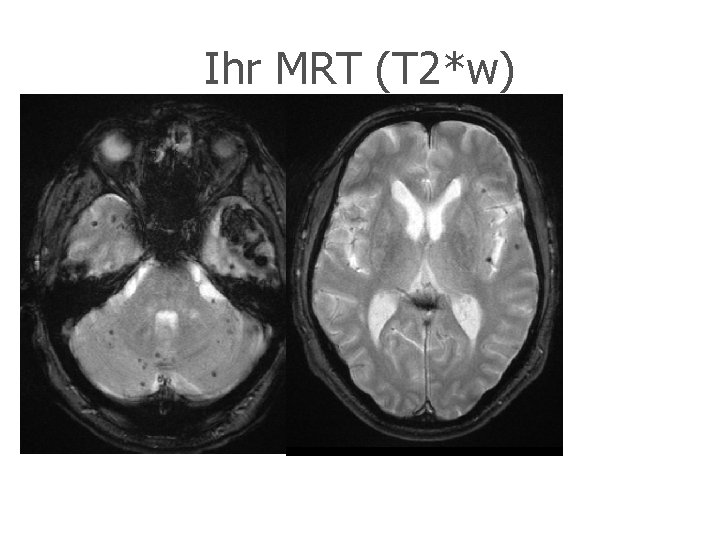 Ihr MRT (T 2*w) 