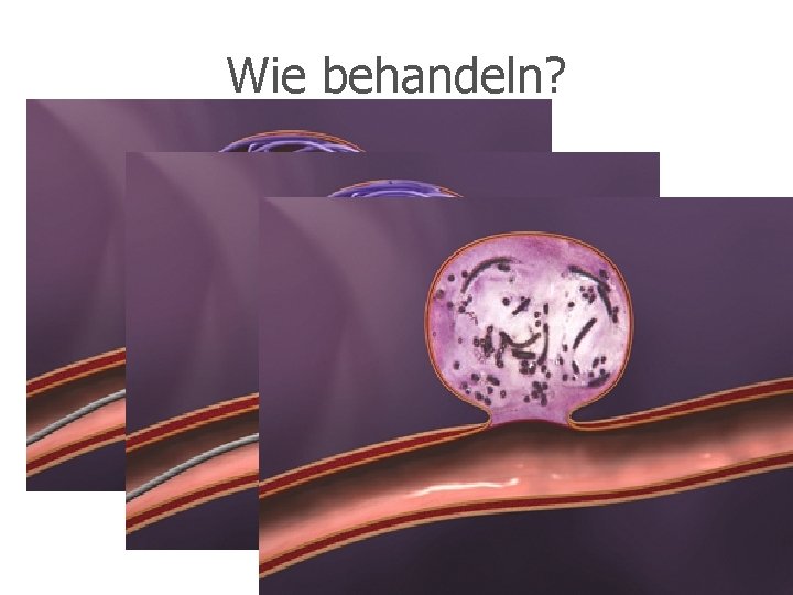 Wie behandeln? 