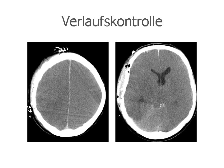 Verlaufskontrolle 